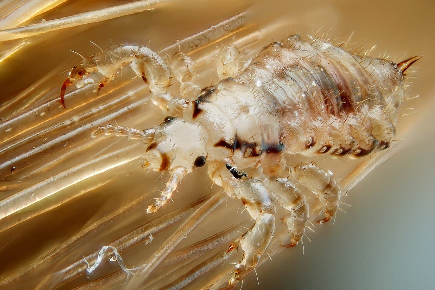 Galvos utėlė | Gilles San Martin, CC BY-SA 2.0, Wikimedia Commons Galvos utėlė (Pediculus humanus capitis) ant plaukų